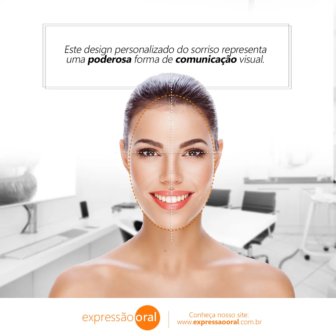 Peça sobre Digital Smile Design — Expressão Oral