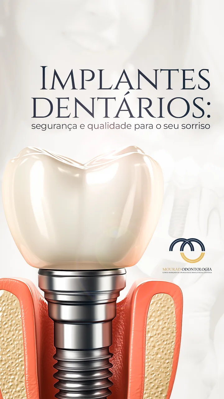 Story sobre implantes dentários — Mourad Odontologia