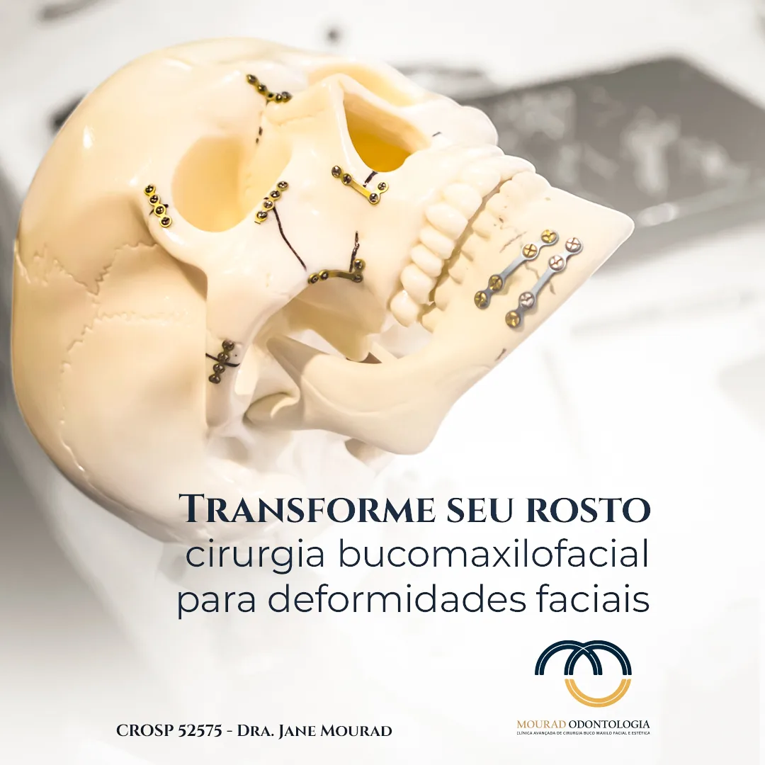 Post sobre cirurgia para deformidades faciais — Mourad Odontologia