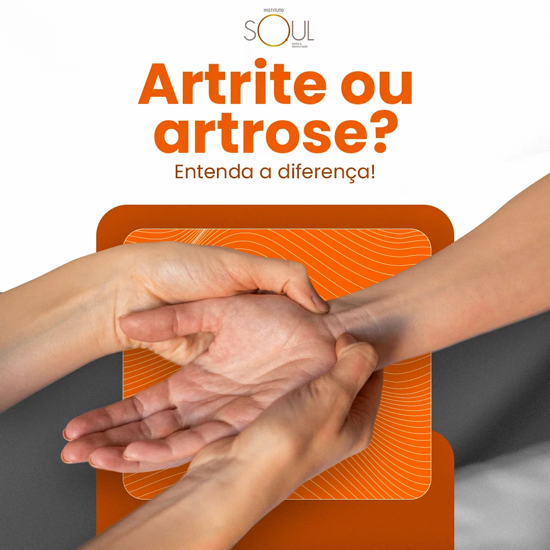 Post do Instituto Soul com o título 'Artrite ou artrose? Entenda a diferença!' e foto de mãos em avaliação sobre painel laranja