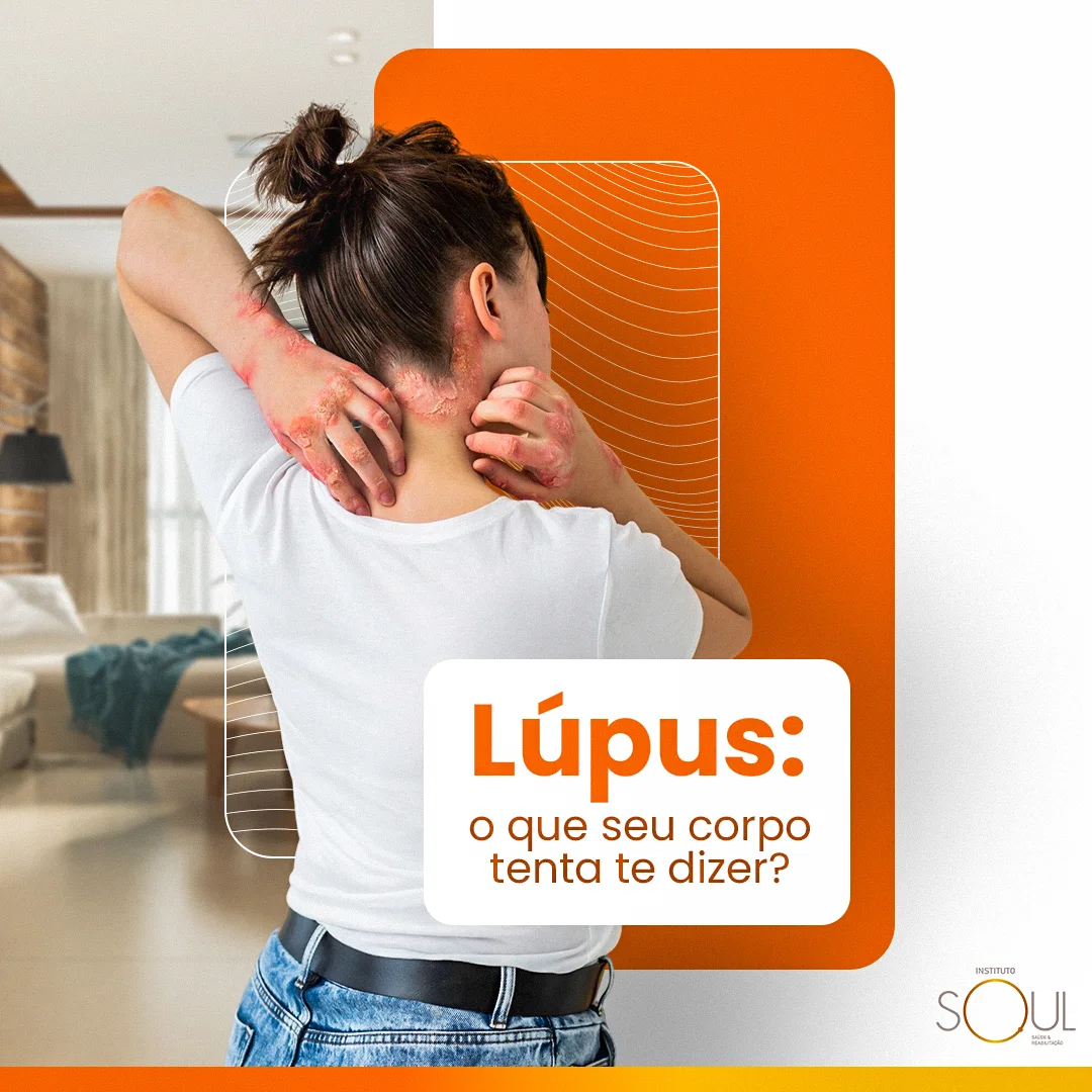 Post 'Lúpus: o que seu corpo tenta te dizer?' com mulher de costas coçando a nuca sobre bloco laranja vibrante